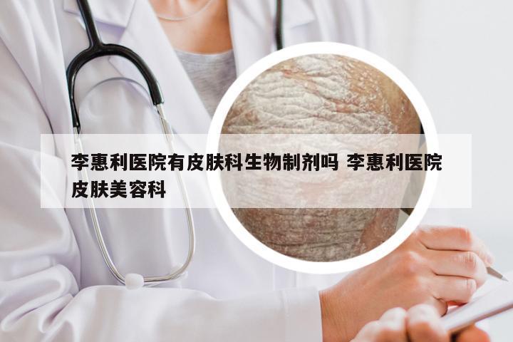 李惠利医院有皮肤科生物制剂吗 李惠利医院皮肤美容科