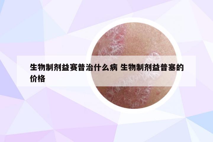 生物制剂益赛普治什么病 生物制剂益普塞的价格