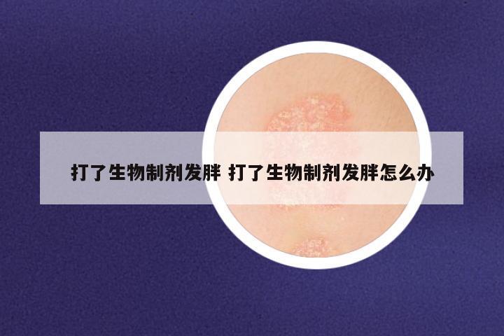 打了生物制剂发胖 打了生物制剂发胖怎么办