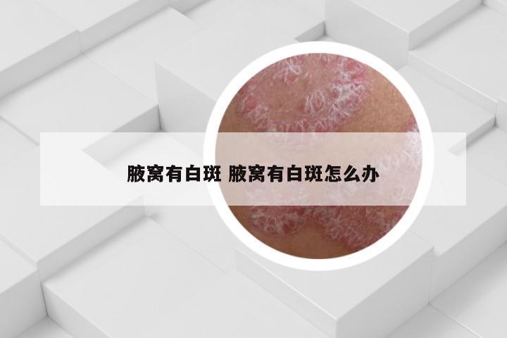 腋窝有白斑 腋窝有白斑怎么办