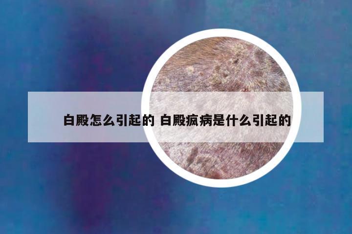 白殿怎么引起的 白殿疯病是什么引起的