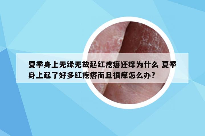 夏季身上无缘无故起红疙瘩还痒为什么 夏季身上起了好多红疙瘩而且很痒怎么办?