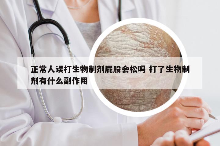 正常人误打生物制剂屁股会松吗 打了生物制剂有什么副作用