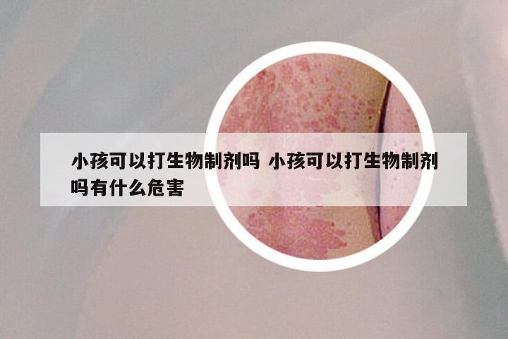 小孩可以打生物制剂吗 小孩可以打生物制剂吗有什么危害