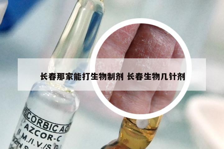 长春那家能打生物制剂 长春生物几针剂