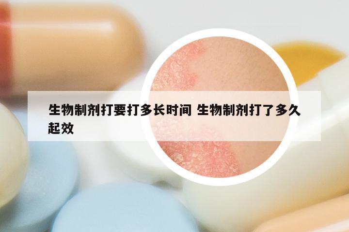 生物制剂打要打多长时间 生物制剂打了多久起效