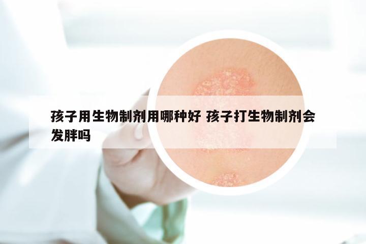 孩子用生物制剂用哪种好 孩子打生物制剂会发胖吗