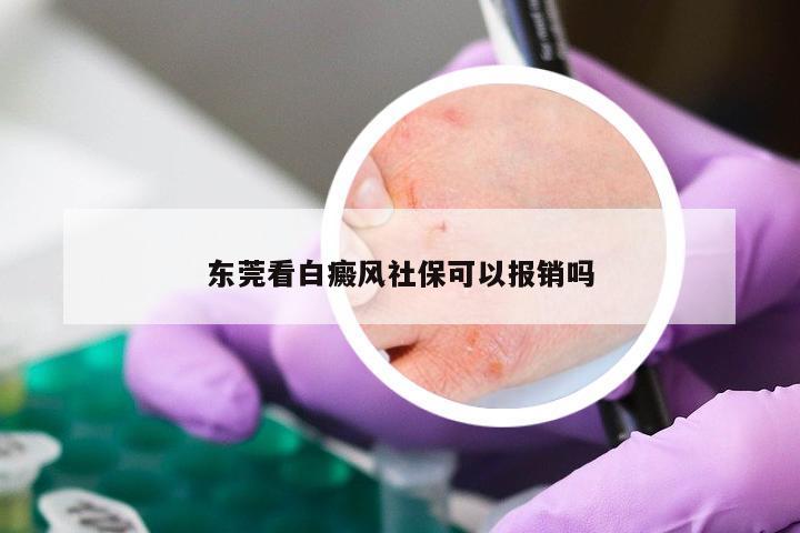 东莞看白癜风社保可以报销吗