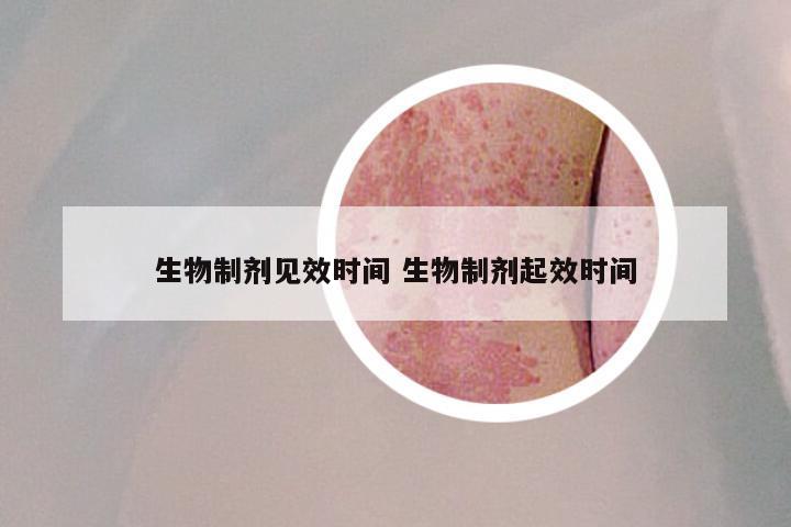 生物制剂见效时间 生物制剂起效时间