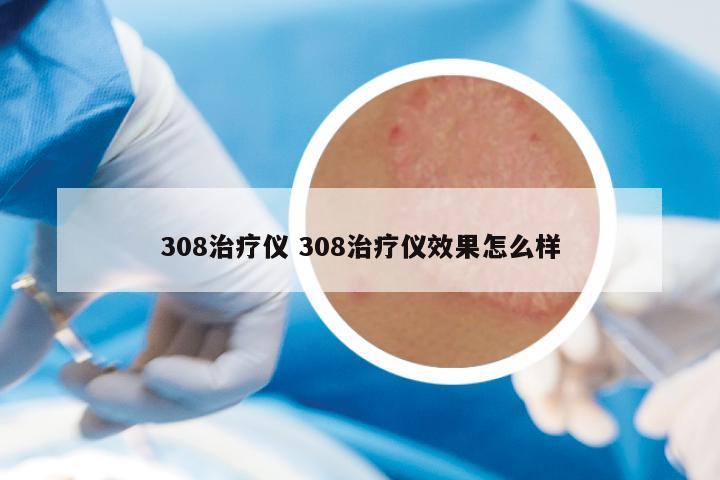 308治疗仪 308治疗仪效果怎么样