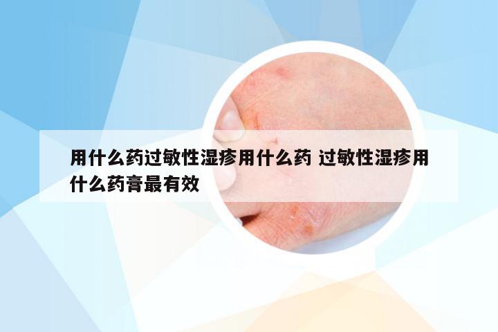 用什么药过敏性湿疹用什么药 过敏性湿疹用什么药膏最有效