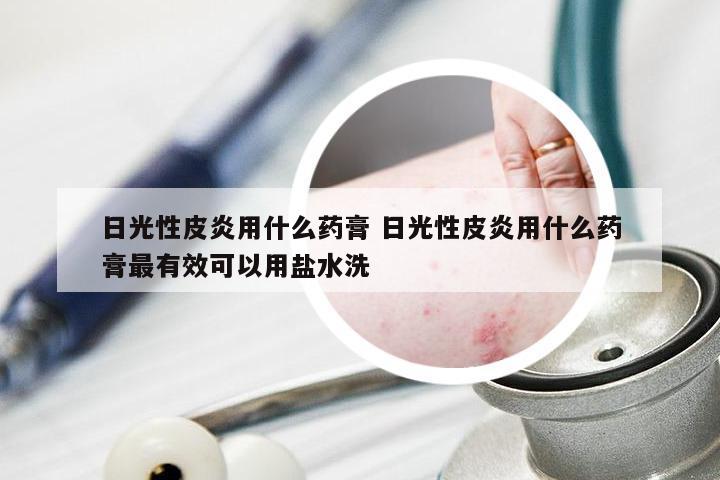 日光性皮炎用什么药膏 日光性皮炎用什么药膏最有效可以用盐水洗