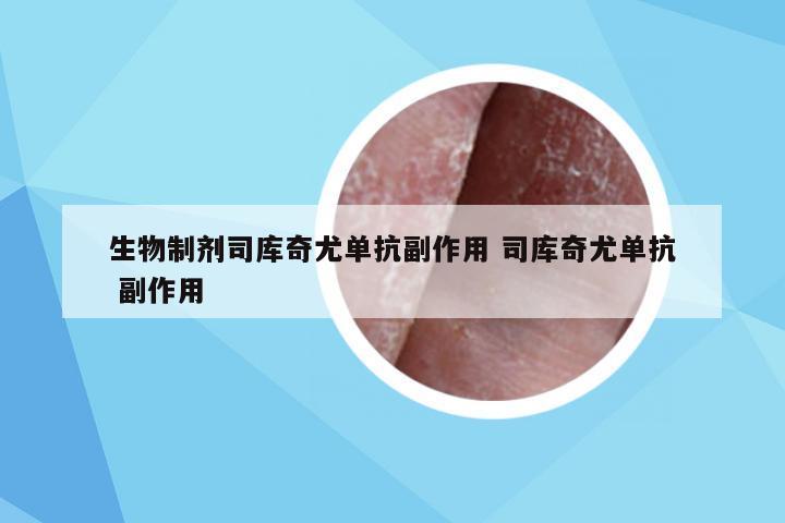 生物制剂司库奇尤单抗副作用 司库奇尤单抗 副作用