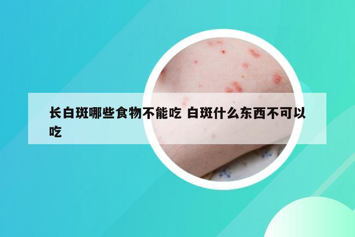 长白斑哪些食物不能吃 白斑什么东西不可以吃