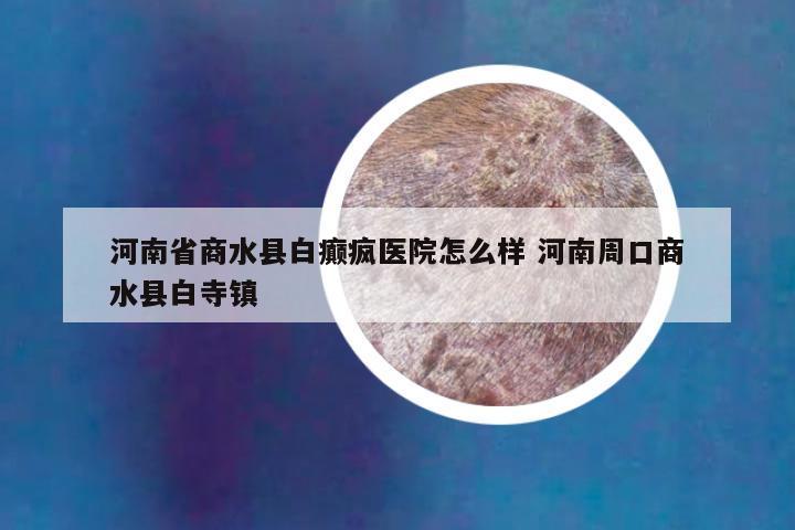 河南省商水县白癫疯医院怎么样 河南周口商水县白寺镇