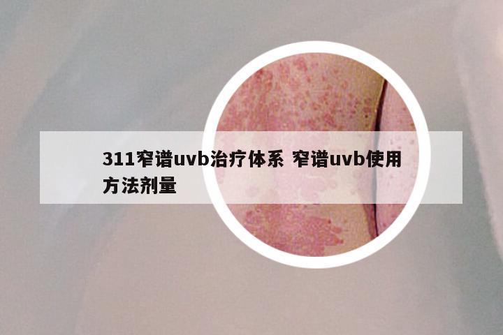 311窄谱uvb治疗体系 窄谱uvb使用方法剂量