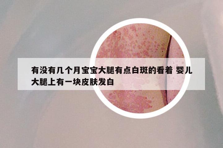 有没有几个月宝宝大腿有点白斑的看着 婴儿大腿上有一块皮肤发白