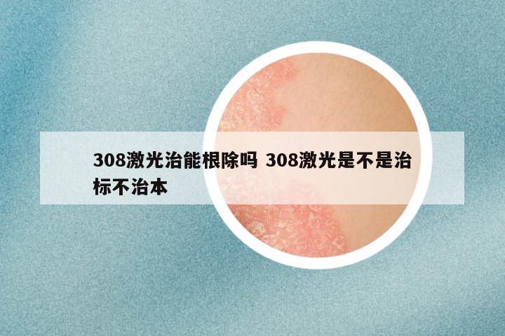 308激光治能根除吗 308激光是不是治标不治本