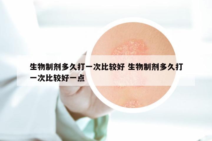 生物制剂多久打一次比较好 生物制剂多久打一次比较好一点