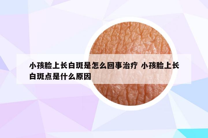 小孩脸上长白斑是怎么回事治疗 小孩脸上长白斑点是什么原因