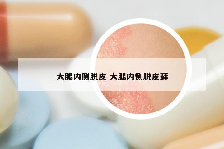 大腿内侧脱皮 大腿内侧脱皮藓