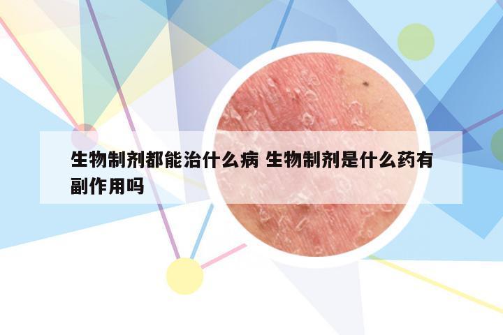 生物制剂都能治什么病 生物制剂是什么药有副作用吗