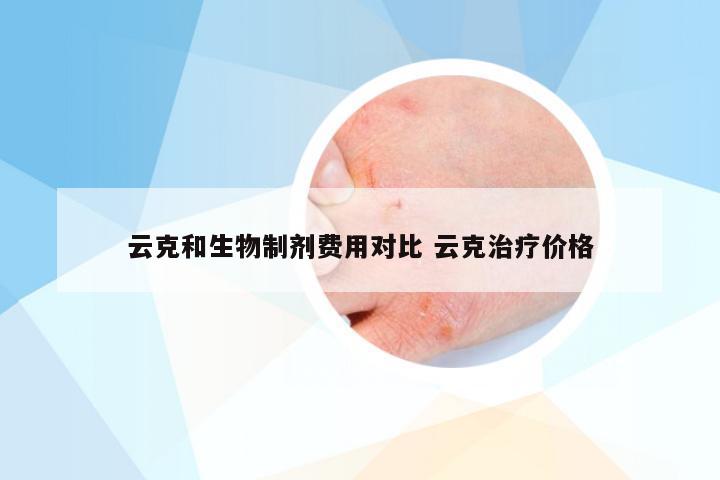 云克和生物制剂费用对比 云克治疗价格