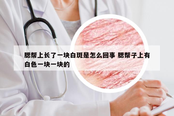 腮帮上长了一块白斑是怎么回事 腮帮子上有白色一块一块的