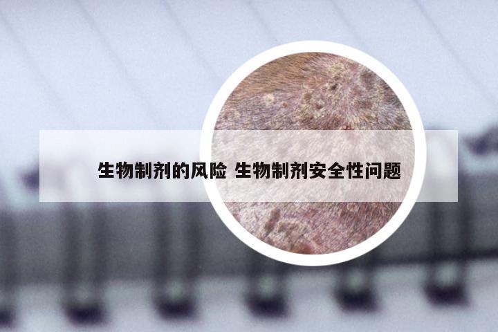 生物制剂的风险 生物制剂安全性问题