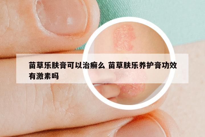 苗草乐肤膏可以治癣么 苗草肤乐养护膏功效有激素吗