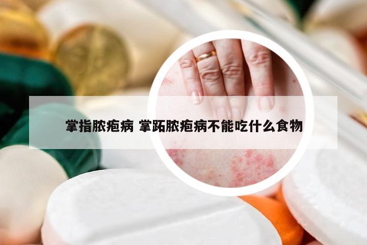 掌指脓疱病 掌跖脓疱病不能吃什么食物