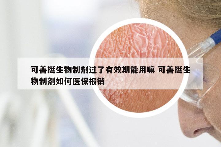 可善挺生物制剂过了有效期能用嘛 可善挺生物制剂如何医保报销