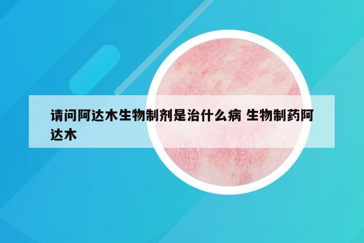 请问阿达木生物制剂是治什么病 生物制药阿达木