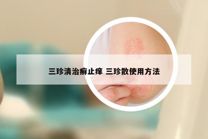 三珍清治癣止痒 三珍散使用方法