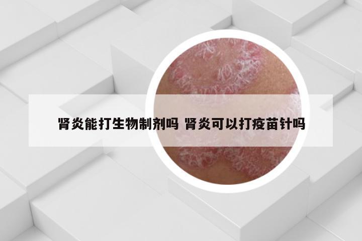 肾炎能打生物制剂吗 肾炎可以打疫苗针吗