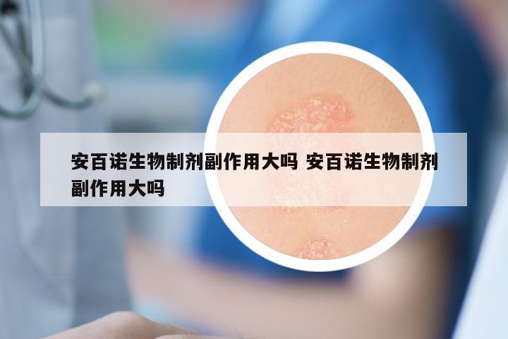 安百诺生物制剂副作用大吗 安百诺生物制剂副作用大吗