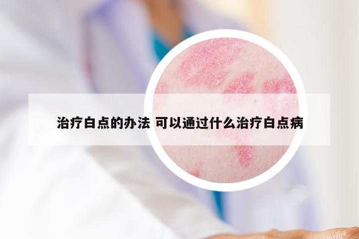 治疗白点的办法 可以通过什么治疗白点病