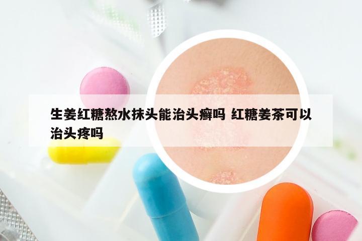 生姜红糖熬水抹头能治头癣吗 红糖姜茶可以治头疼吗