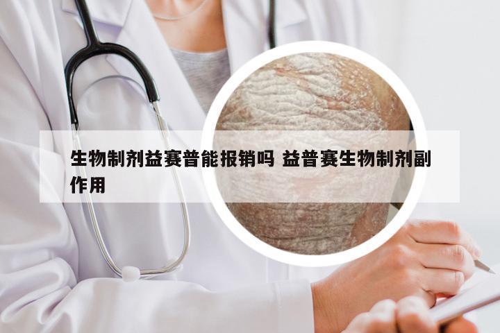 生物制剂益赛普能报销吗 益普赛生物制剂副作用