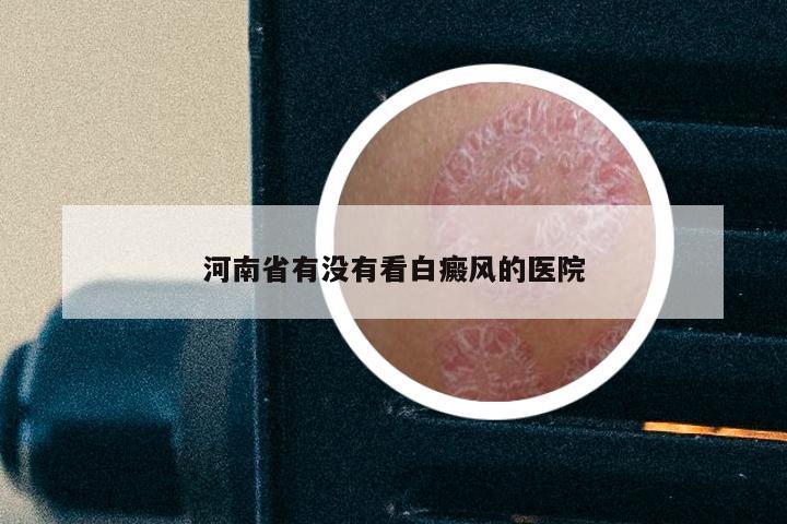 河南省有没有看白癜风的医院