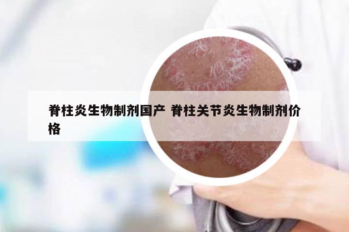 脊柱炎生物制剂国产 脊柱关节炎生物制剂价格