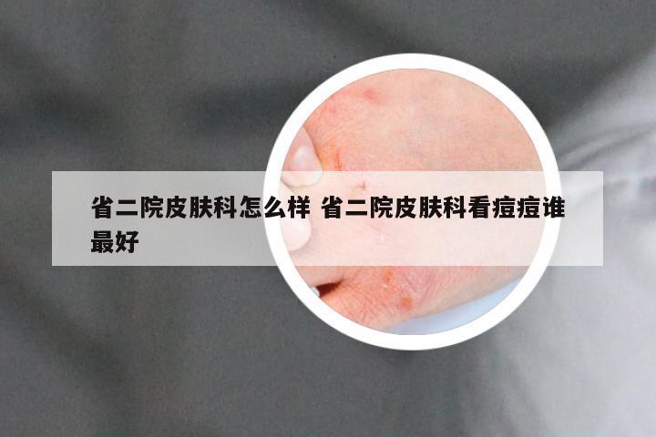 省二院皮肤科怎么样 省二院皮肤科看痘痘谁最好