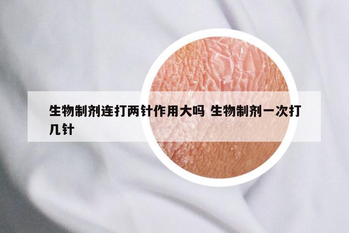 生物制剂连打两针作用大吗 生物制剂一次打几针