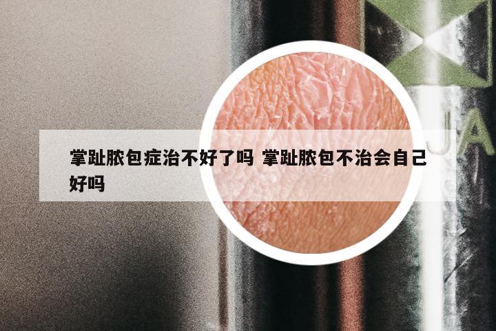 掌趾脓包症治不好了吗 掌趾脓包不治会自己好吗