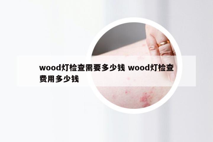 wood灯检查需要多少钱 wood灯检查费用多少钱