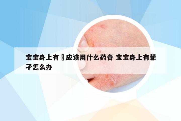 宝宝身上有廯应该用什么药膏 宝宝身上有菲孑怎么办