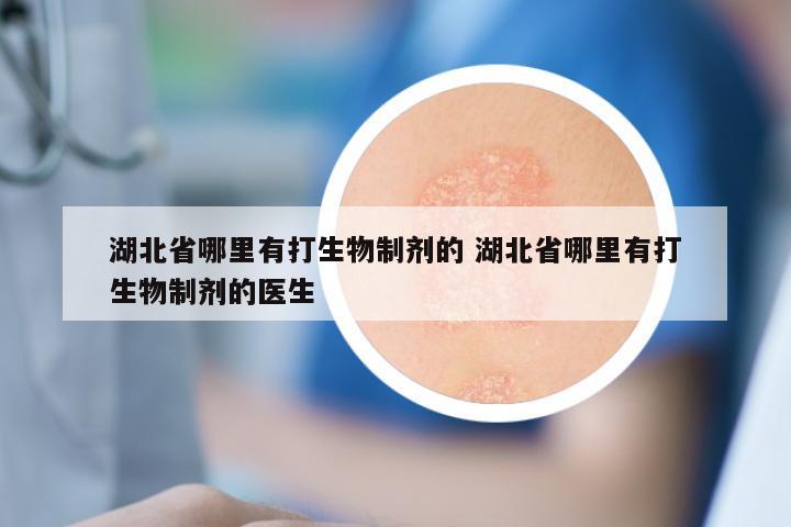 湖北省哪里有打生物制剂的 湖北省哪里有打生物制剂的医生