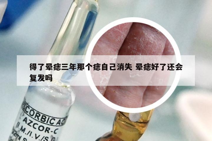 得了晕痣三年那个痣自己消失 晕痣好了还会复发吗