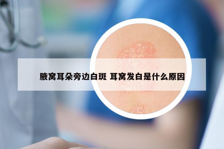 腋窝耳朵旁边白斑 耳窝发白是什么原因