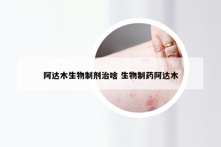 阿达木生物制剂治啥 生物制药阿达木